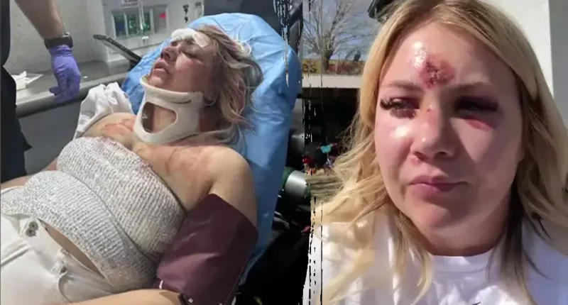 Bride-to-be left with broken nose, teeth after brutal bachelorette attack: police