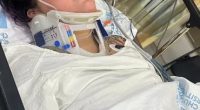 Woman in hospital bed wearing neck brace.
