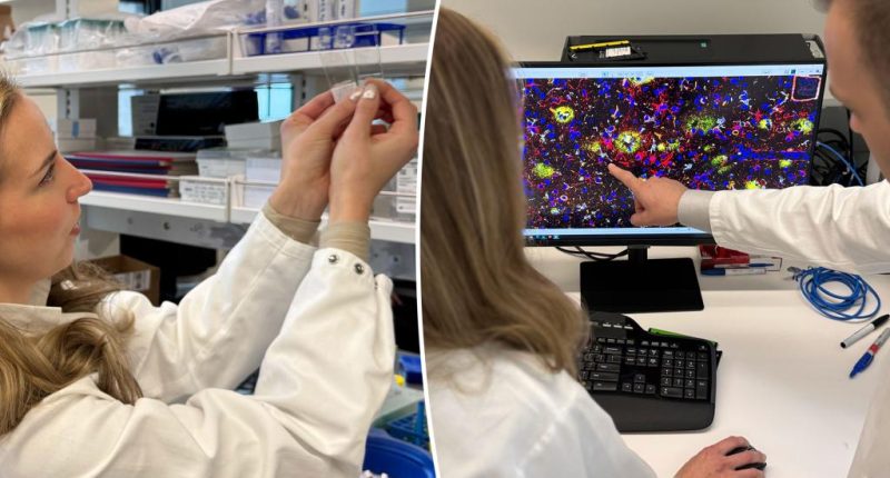Key brain discovery could revolutionize Alzheimer's treatment