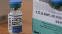 Measles case confirmed in Maryland resident who recently travelled abroad
