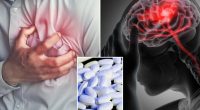 These pills can cut heart attack, stroke risk: new study