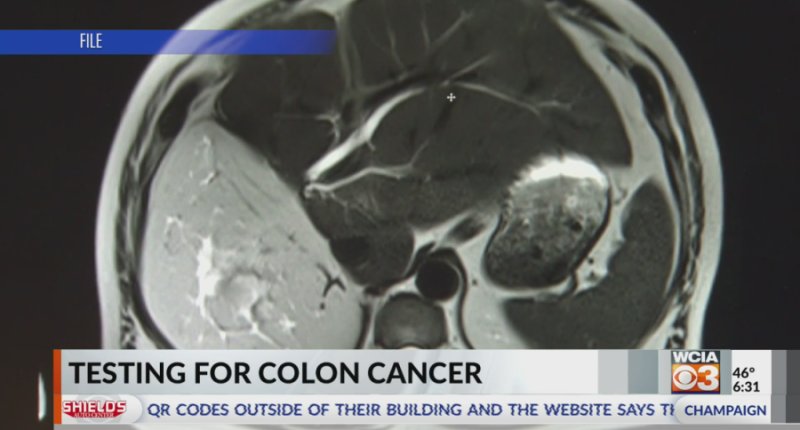 'It's not that bad': 15-year-old encourages people to get tested for colon cancer