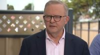 Anthony Albanese