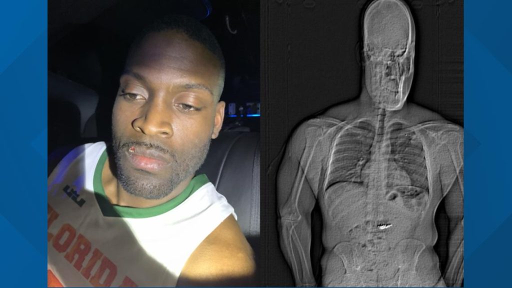 Florida man swallows $769K jewelry stolen from Orlando mall, police say