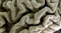 Illinois House moves bill for Alzheimer's treatment forward