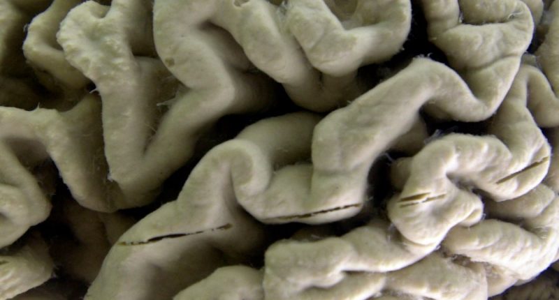 Illinois House moves bill for Alzheimer's treatment forward
