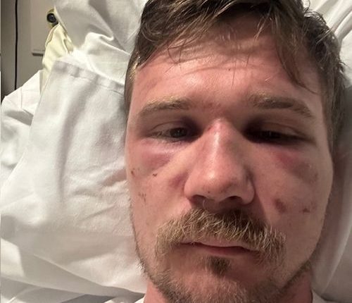 Lawyer losing faith in justice system after teens accused of savage attacks granted bail