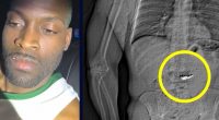 Man swallowed Tiffany jewelry after fleeing robbery: Police