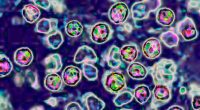 Second measles death reported in ongoing outbreak
