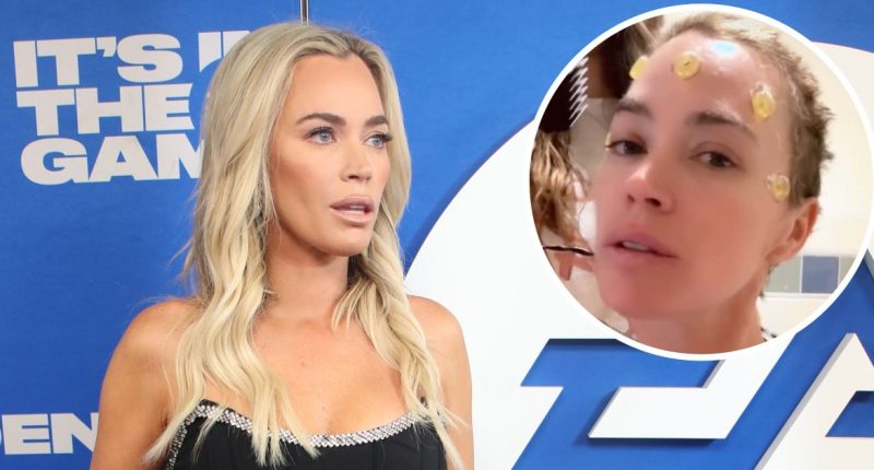 What Happened to Teddi Mellencamp? Health Updates After Cancer Scare