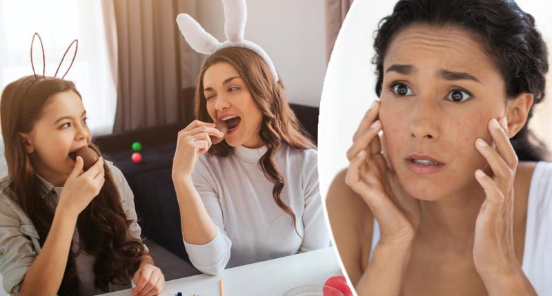 7 hacks to save your skin after an Easter candy binge