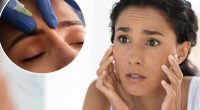 Botox budget-friendly hacks