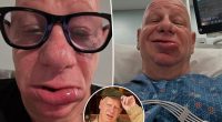 Comedian Jeff Ross 'spent the night in the ER' with allergic reaction to ice cream