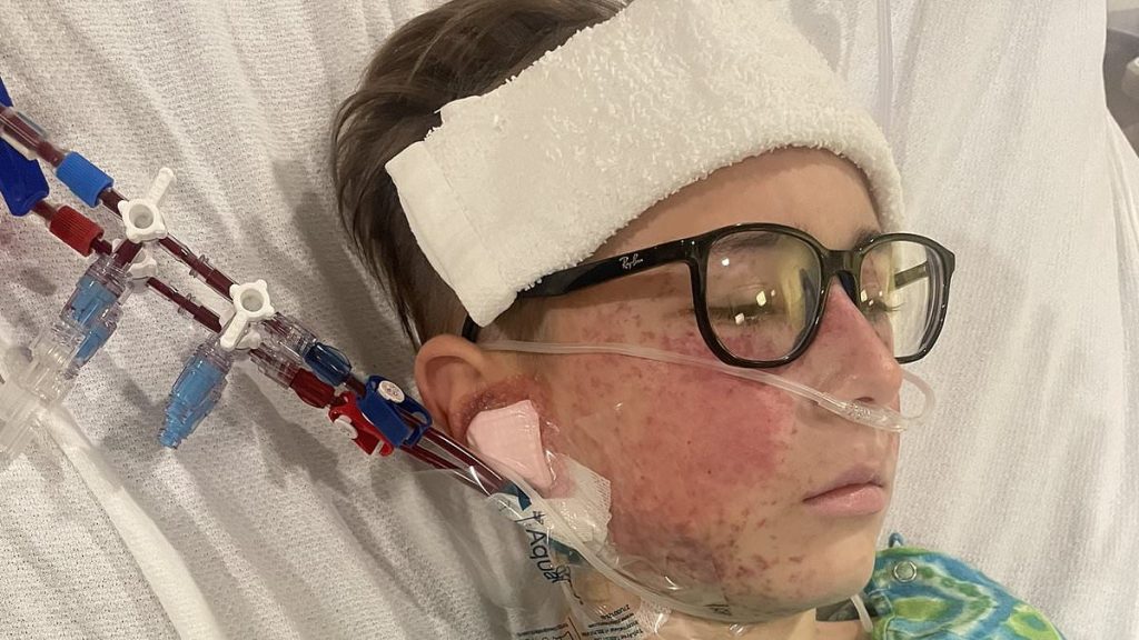 'Health' food contaminated with E. coli kills one and sickens 90