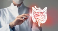 How to Manage a Diverticulitis Flare-Up: 4 Expert-Recommended Self-Care Tips