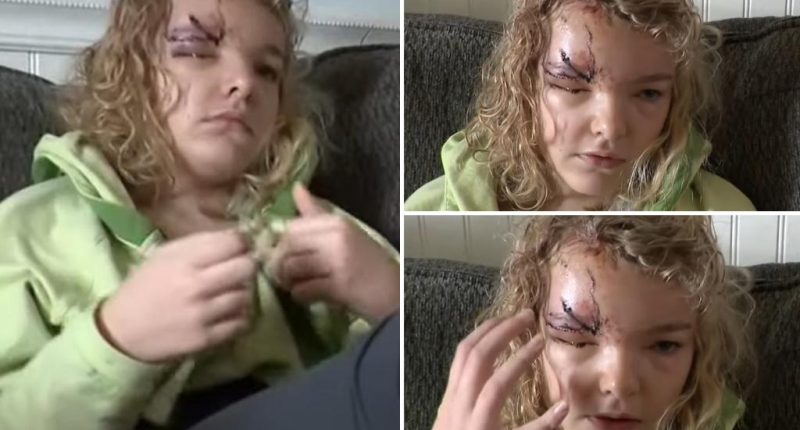 Long Island girl mauled by neighbor's pitbull