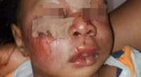 Parents of baby mauled by dog at Lagos school accuses proprietress of intimidation and obstruction of justice (video)