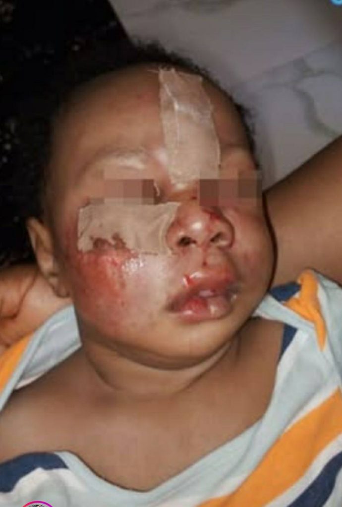 Parents of baby mauled by dog at Lagos school accuses proprietress of intimidation and obstruction of justice (video)