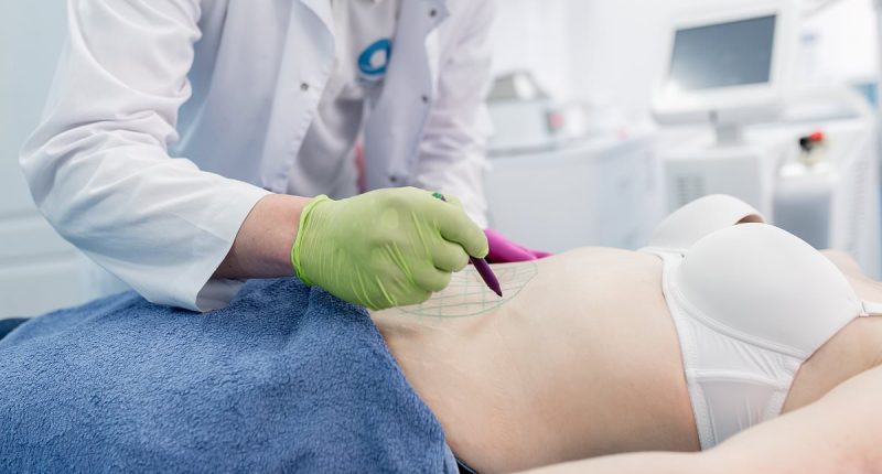Plastic surgeon reveals the SAFEST body alteration you could ever make