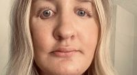 Plastic surgeon who 'butchered women's faces' allowed to carry on
