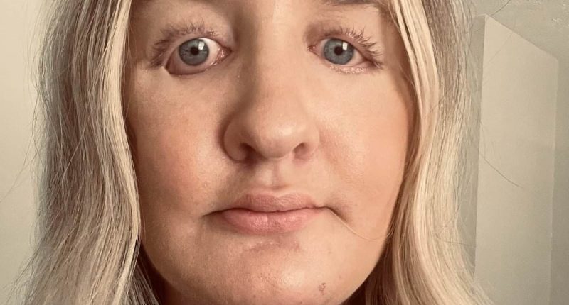Plastic surgeon who 'butchered women's faces' allowed to carry on