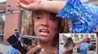 Pro-life activist punched in the face during street interview about abortion