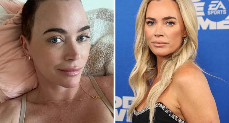 Teddi Mellencamp Confirms She Has Stage 4 Melanoma In Emotional Interview After Cancer Spread To Her Lungs And Brain