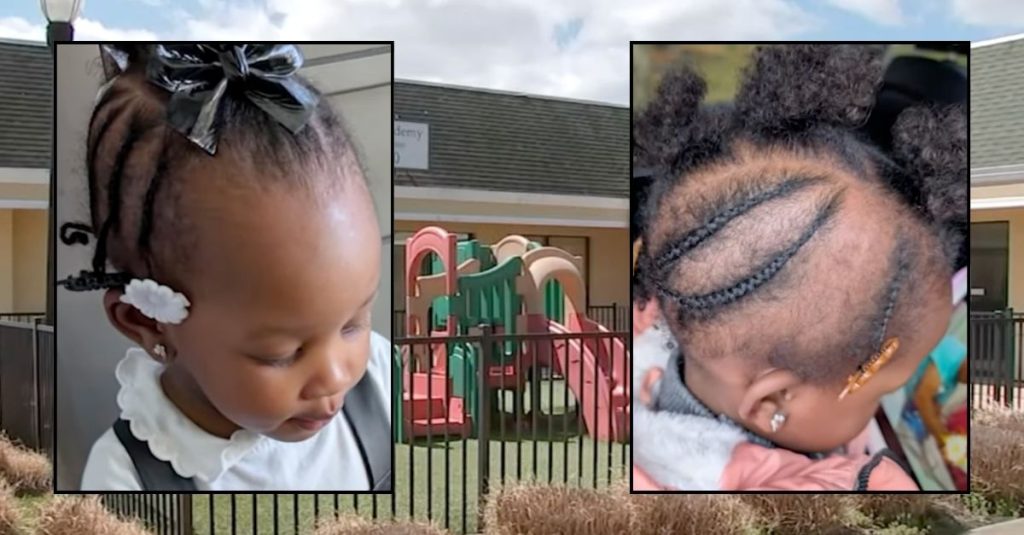 2-year-old leaves day care with braid yanked out, mom suing