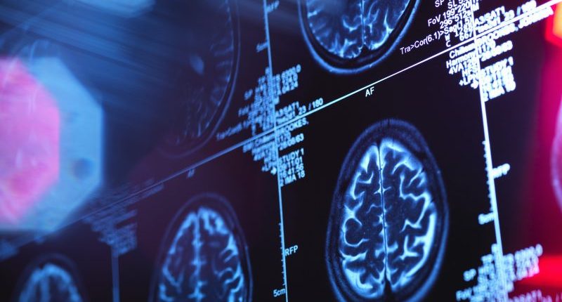 3 cases of rare brain disease reported in Oregon