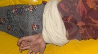 9-year-old boy’s hands bound at Las Vegas childcare facility: 'I couldn't pull it apart'