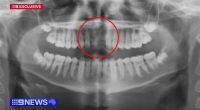 Alleged school bashing leaves 14-year-old without two front teeth