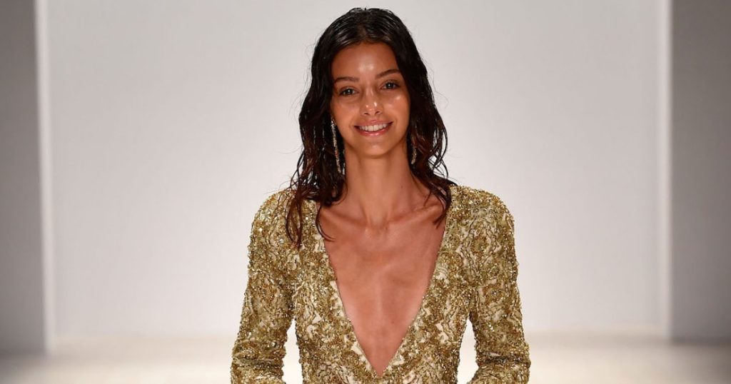 Australian Model Dead at 27 After Battling Rare Brain Condition