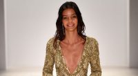 Australian Model Dead at 27 After Battling Rare Brain Condition