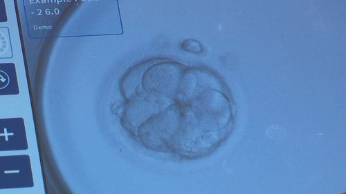 The fertility rebate was an Australian first introduced by the ﻿previous Berejiklian Government.