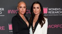 Brave Teddi Mellencamp exposes scars from brain surgery on red carpet