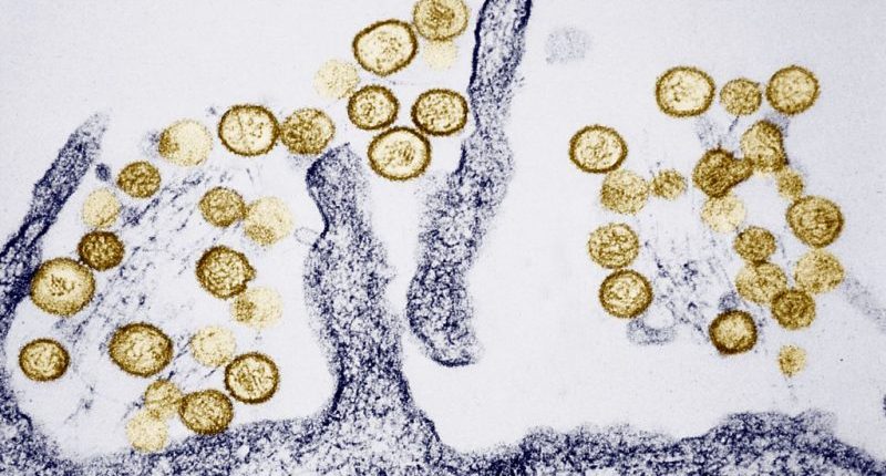 California town reports third fatality related to rare virus linked to death of Gene Hackman's wife