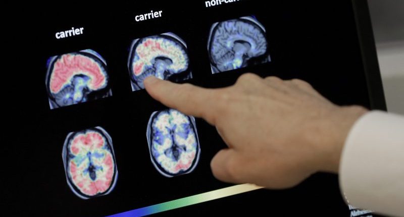 Can you have a stroke without realizing?