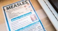 MAP: Where are the biggest measles outbreaks in the US right now?