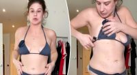 Makeup-free Remi Bader shows haters her loose skin and scars from weight-loss surgery