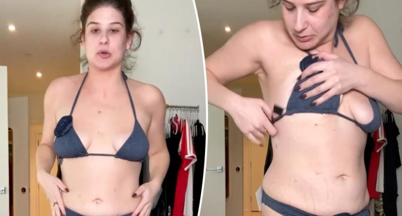 Makeup-free Remi Bader shows haters her loose skin and scars from weight-loss surgery