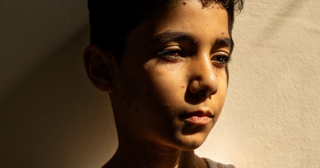 Portrait of Palestinian boy who lost both arms in Israeli strike named press photo of the year