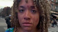 Pro-life activist left bloody after being punched in the face by enraged woman over abortion