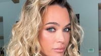 RHOBH's Teddi Mellencamp Shows Brain Surgery Scars