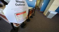 Second child died from measles-related causes in West Texas, where cases are nearing 500