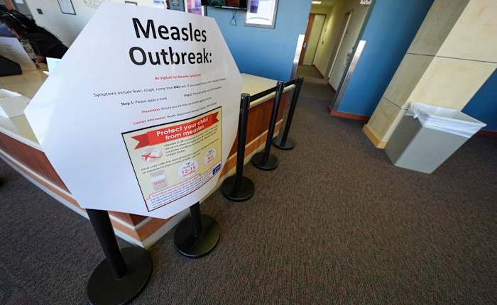 Second child died from measles-related causes in West Texas, where cases are nearing 500