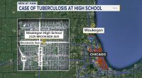 What is tuberculosis? Person at Waukegan High School in Chicago area diagnosed with disease: Lake County Health Department