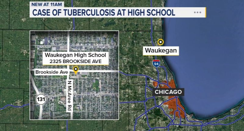 What is tuberculosis? Person at Waukegan High School in Chicago area diagnosed with disease: Lake County Health Department
