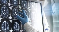 What to do and not do if someone is having a stroke