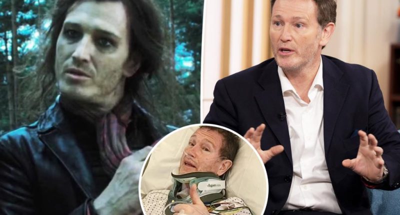 ‘Harry Potter’ actor rushed to hospital with ‘life-threatening’ injury, told he ‘might never walk or talk again’
