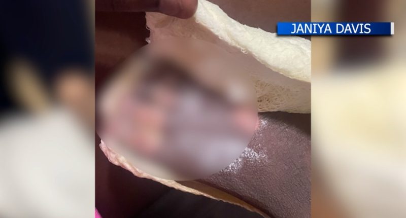 'I screamed': Woman, toddler suffer 3rd-degree burns from charcoal buried in sand